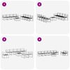Produkta sīktēla attēls 8 no 11